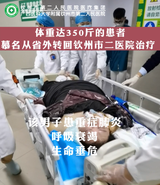 體重350斤的生命垂�；颊吣矫麖氖⊥廪D(zhuǎn)回欽州市二醫(yī)院治療，ECMO治療再創(chuàng)生命奇跡