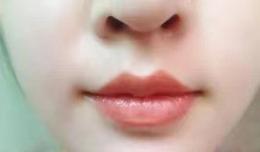 【欽二醫(yī)生說】 手術(shù)麻醉前化妝，讓誰歡喜讓誰憂~